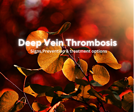 Deep Vein Thrombosis (DVT): A Comprehensive Guide to Symptoms, Causes, Prevention, and Treatment