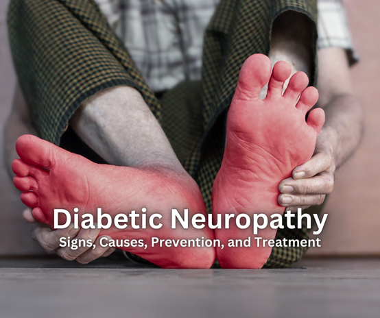 Diabetic Neuropathy: A Comprehensive Guide to Signs, Causes, Prevention, and Treatment